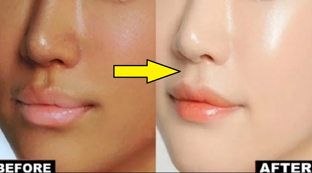 Skin Care Tips
